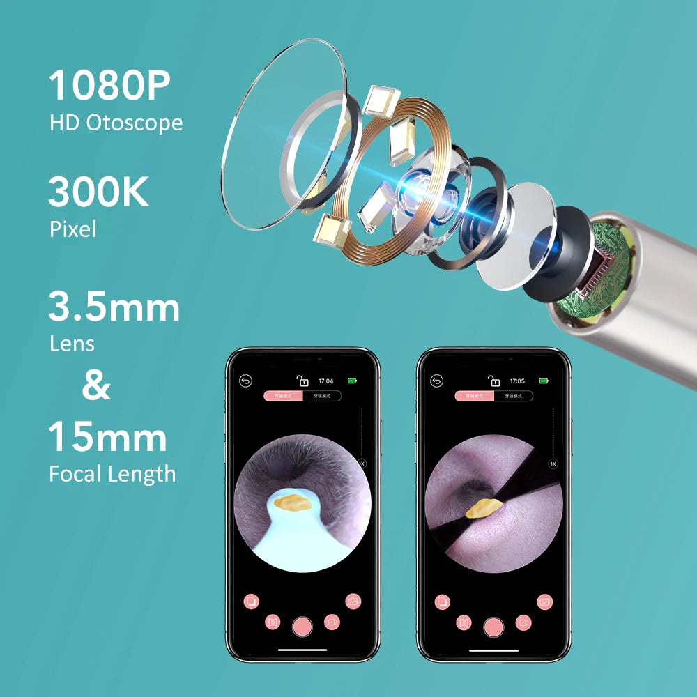 Smart Visual Ear Wax Cleaner with HD Camera - 10