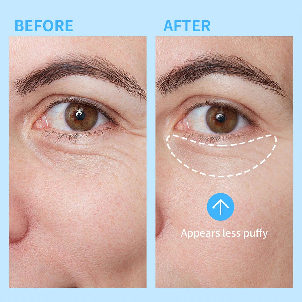 Hydra Bomb Eye Gel for Dark Circles and Puffiness - 11