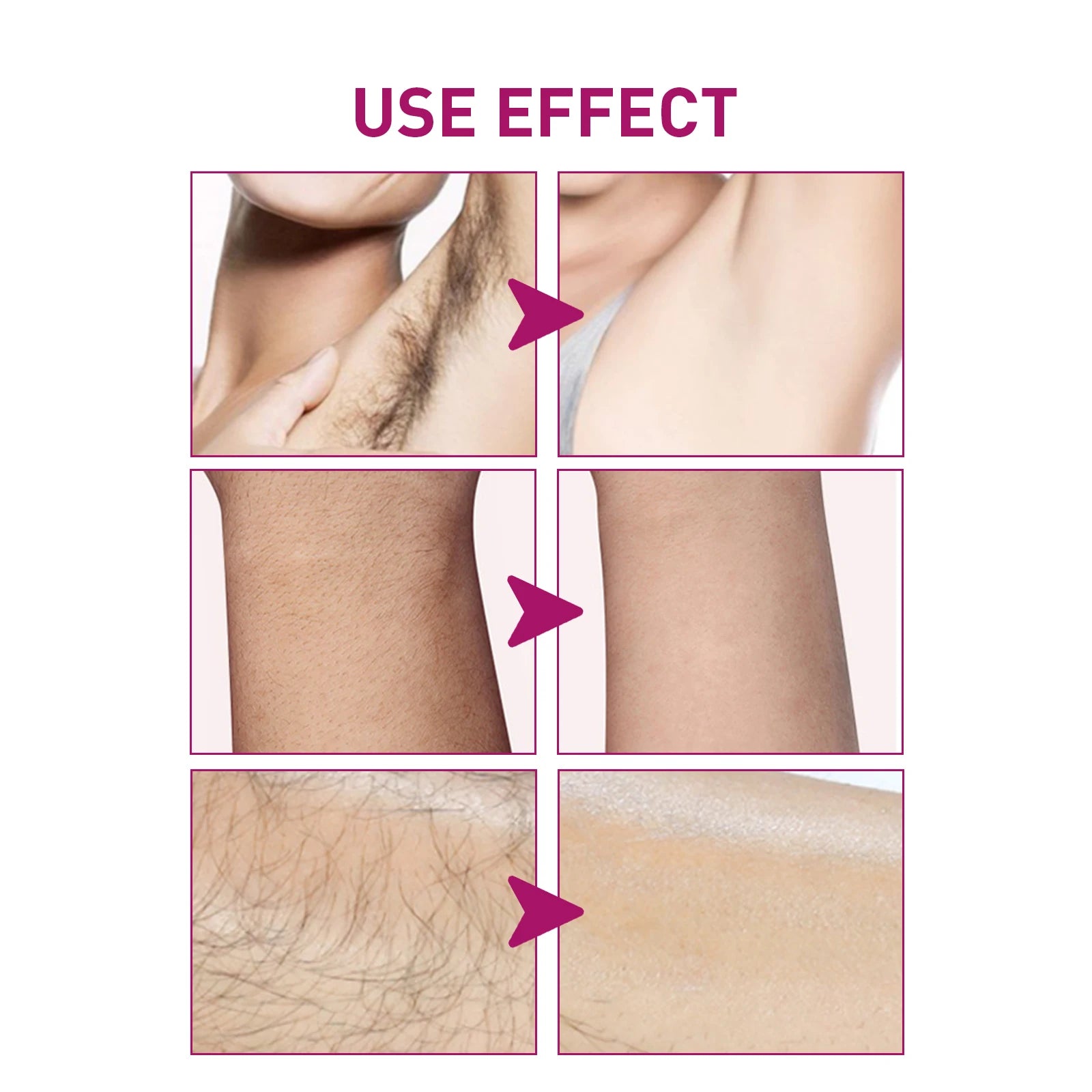 Hair Removal Cream Painless Skin Smoothing Depilatory Formula - 4
