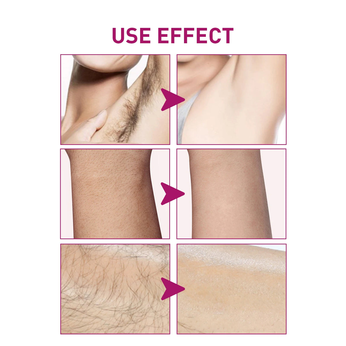 Hair Removal Cream Painless Skin Smoothing Depilatory Formula
