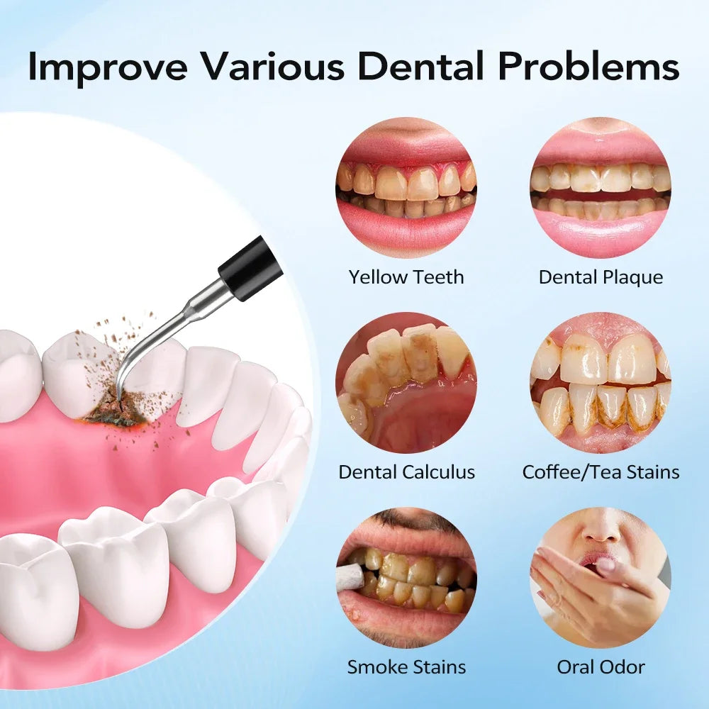 Electric Dental Scaler for Tartar Removal and Teeth Whitening - 5