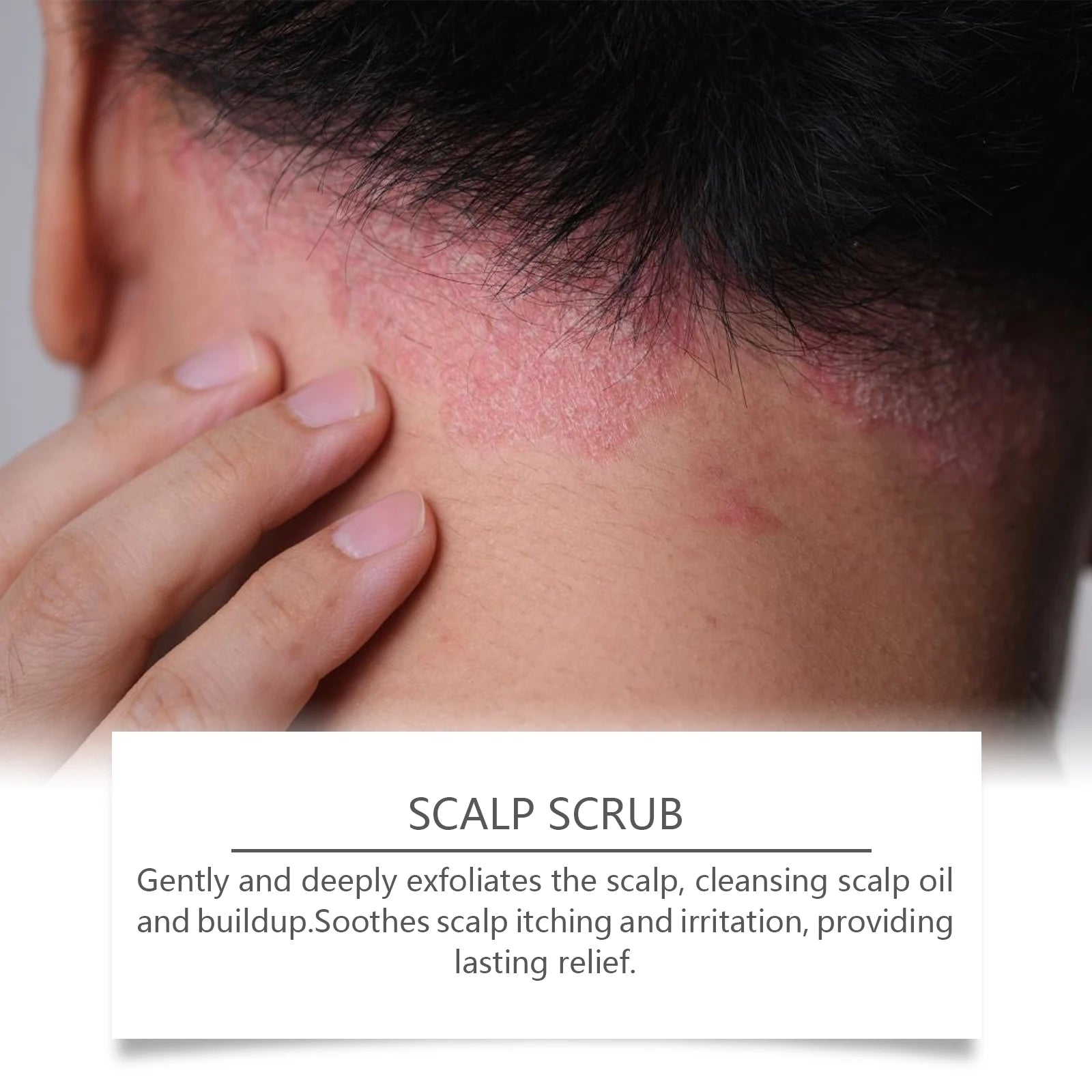 Scalp Scrub Deep Cleansing Exfoliator for Dandruff Relief - 9