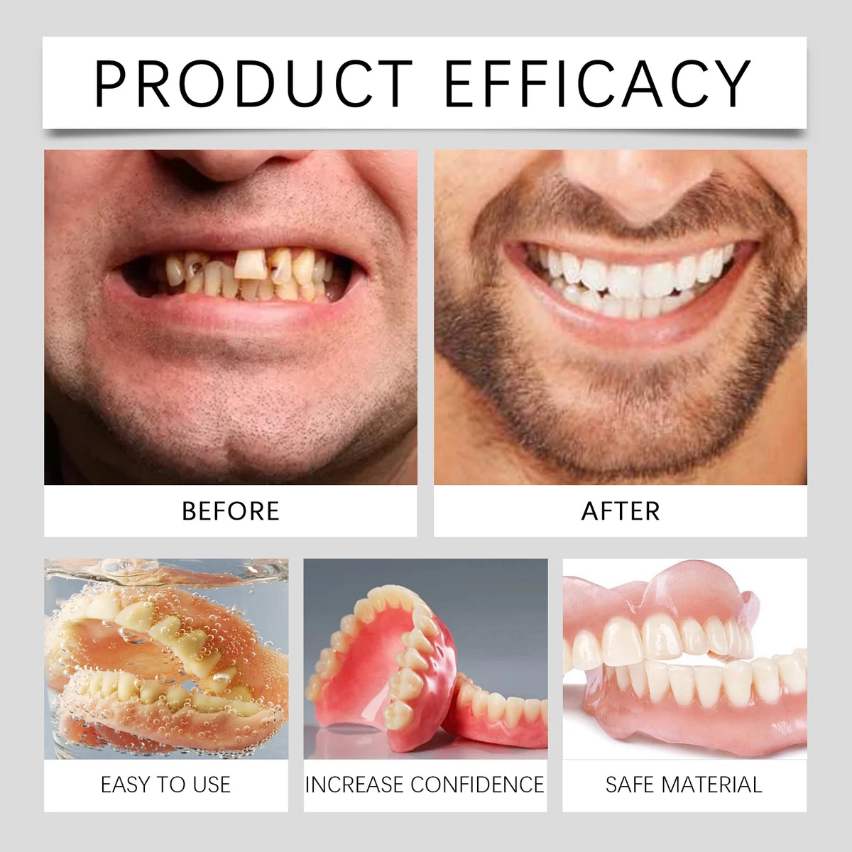 Silicone Dental Veneers for a Natural and Confident Smile