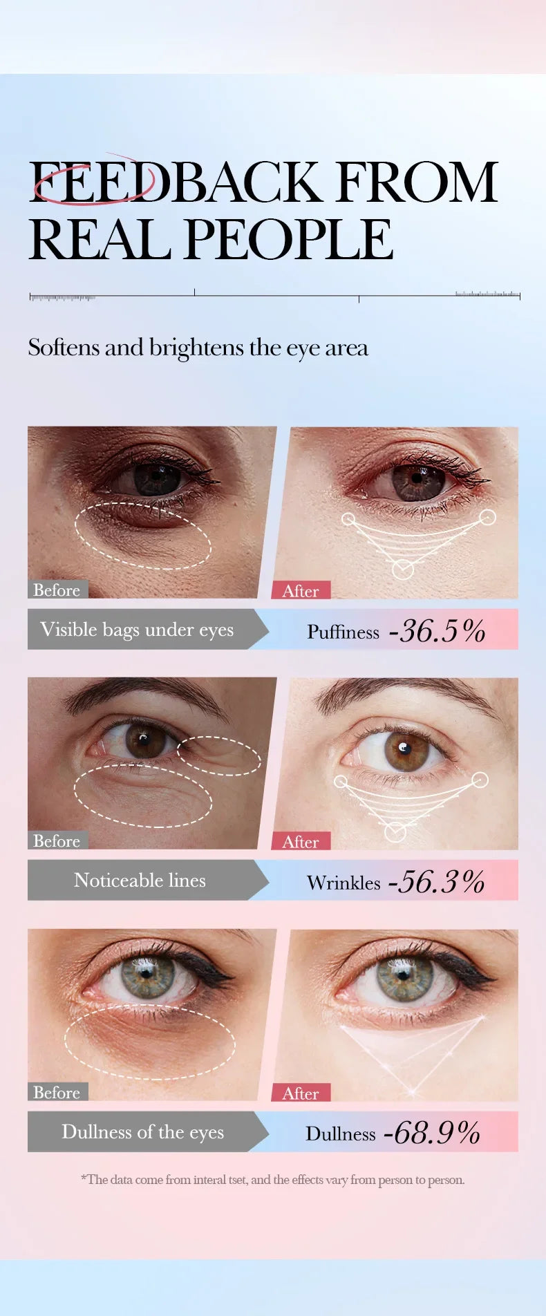 Anti Wrinkle Eye Cream for Firming and Dark Circles - 17