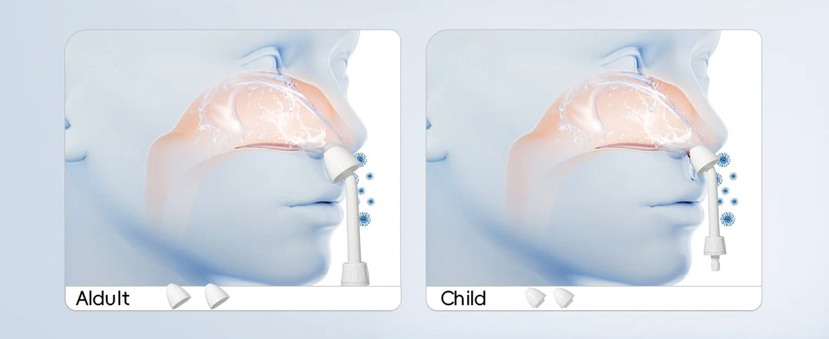 Electric Nasal Irrigator for Easy Sinus Relief