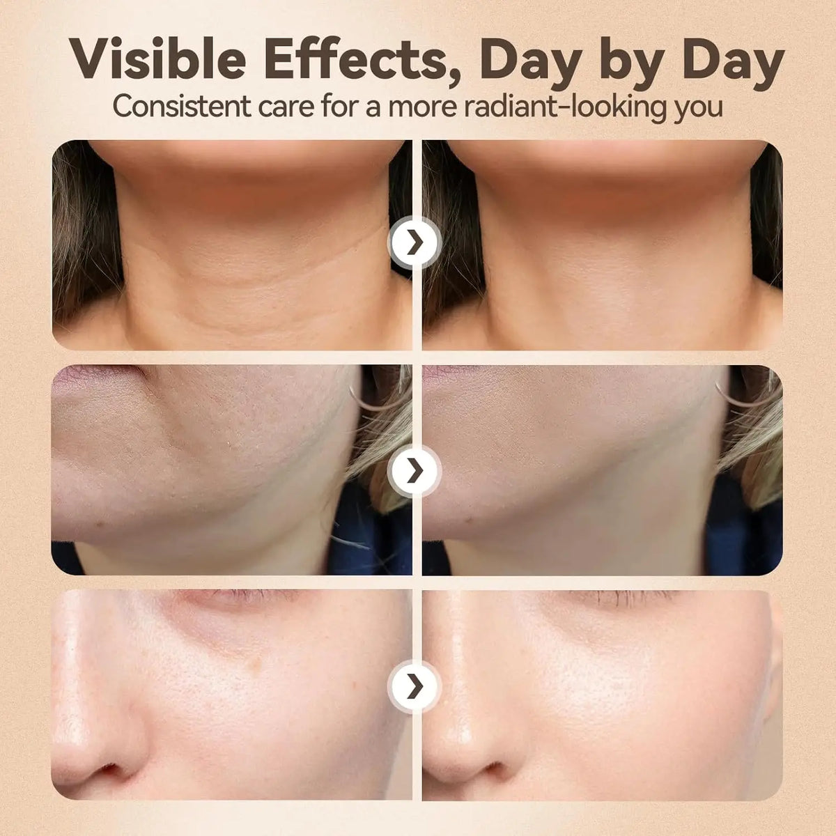 3 in 1 Facial Massager for Skin Tightening and Lifting