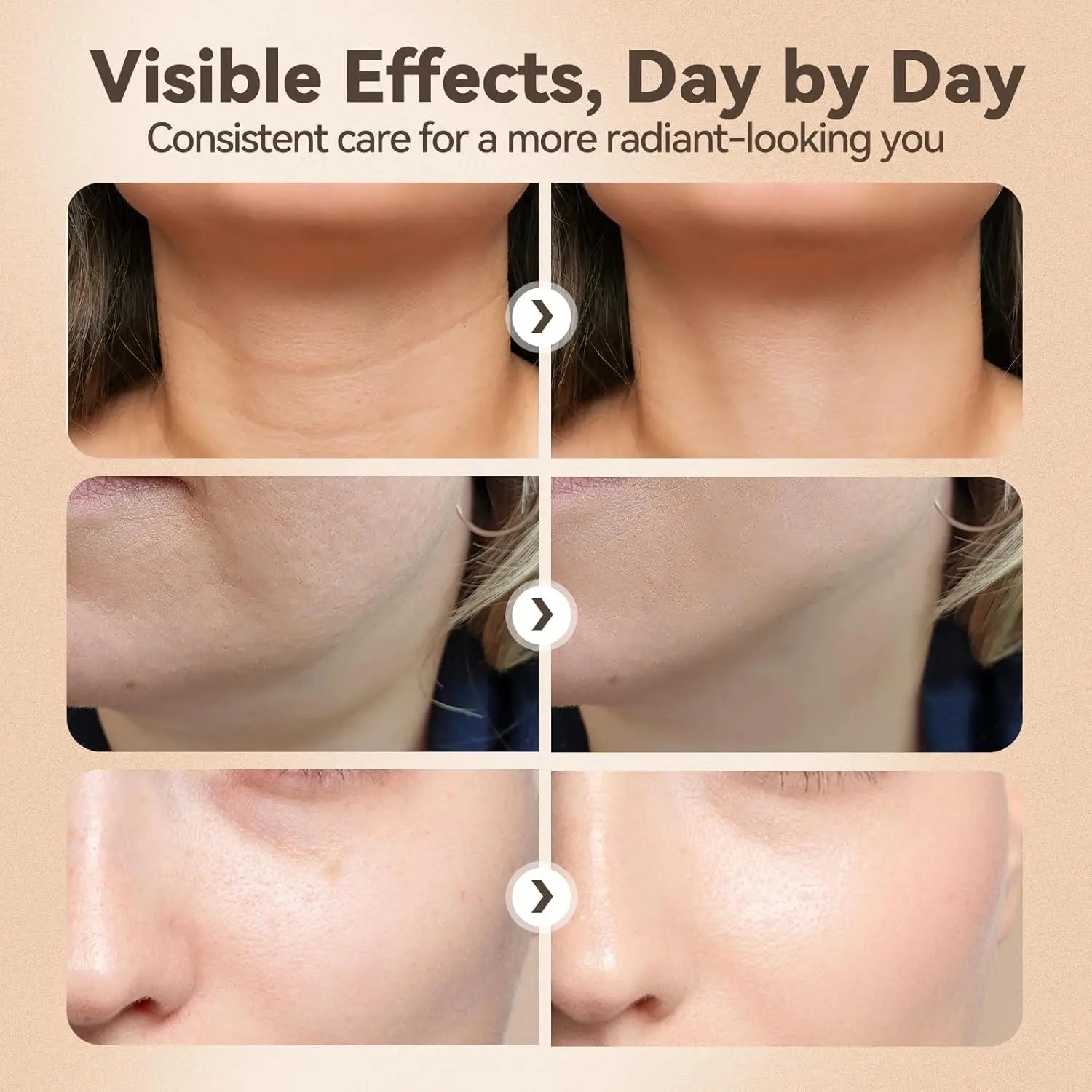 3 in 1 Facial Massager for Skin Tightening and Lifting - 4