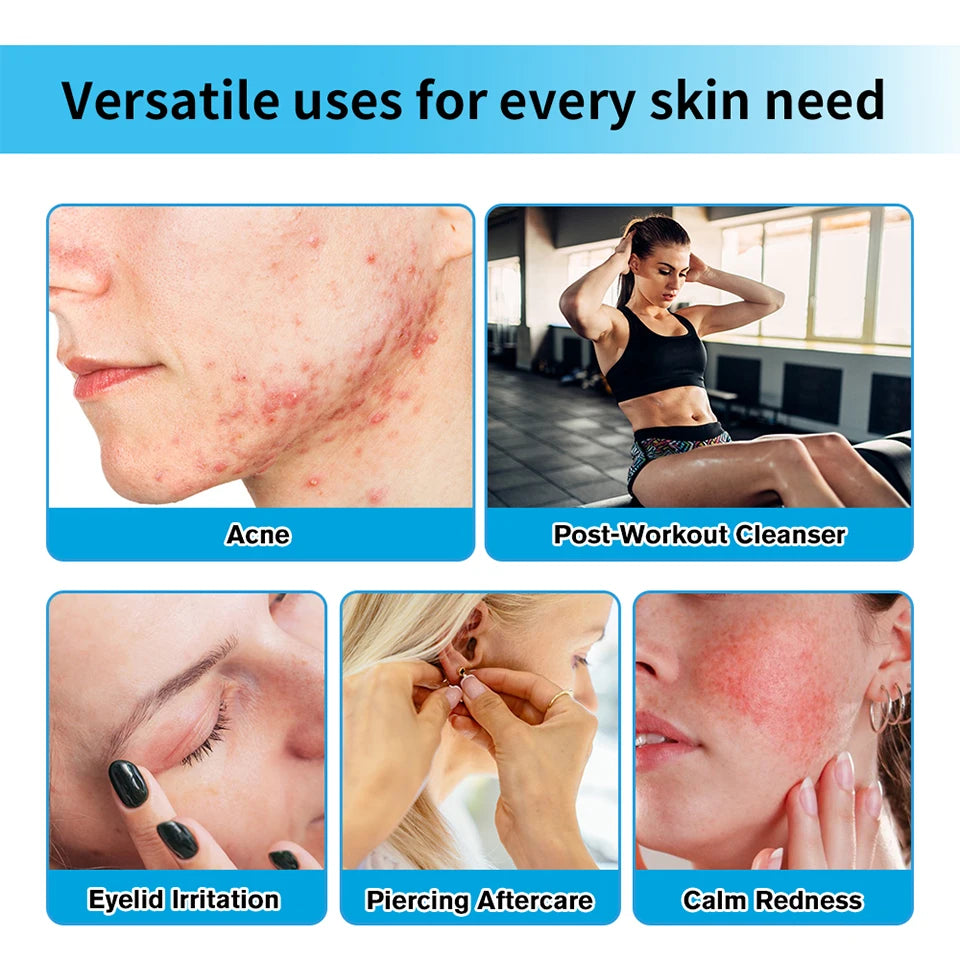 Hypochlorous Acid Facial Spray for Skin Recovery