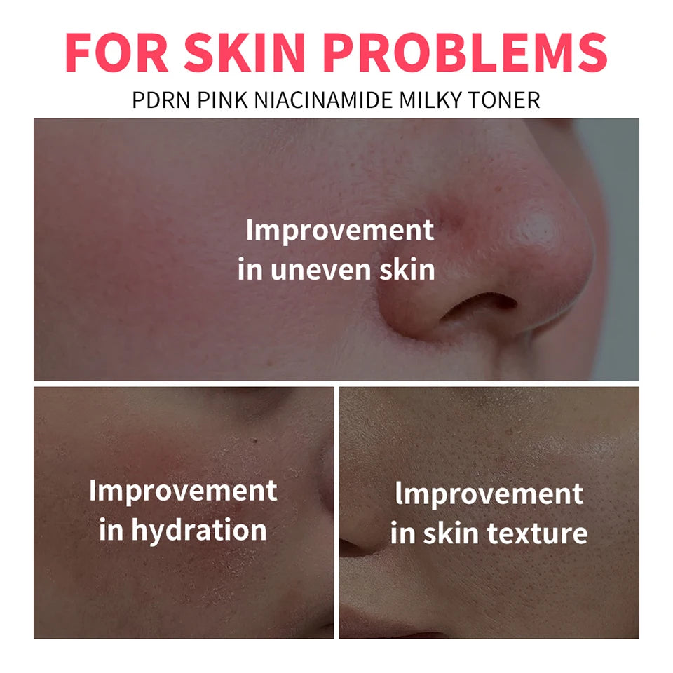 PDRN Niacinamide Milky Toner for Deep Hydration