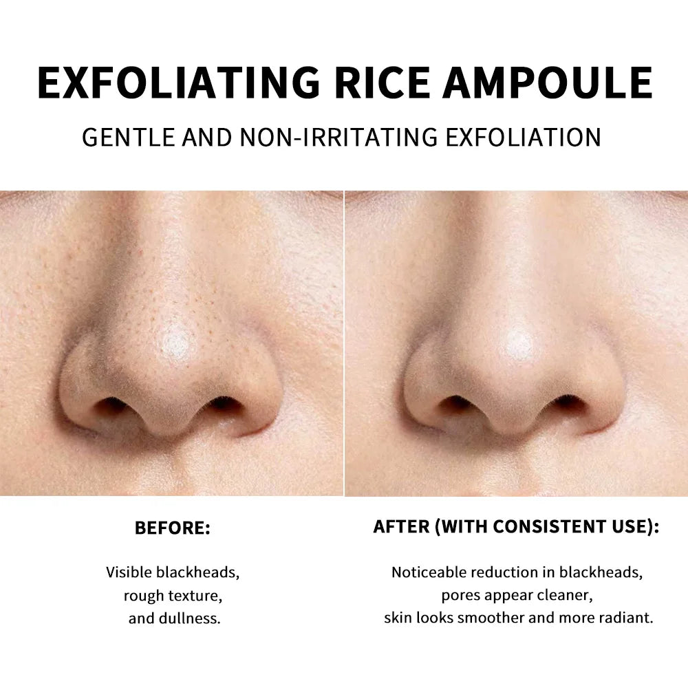 Exfoliating Rice Ampoule for Deep Pore Cleansing and Hydration