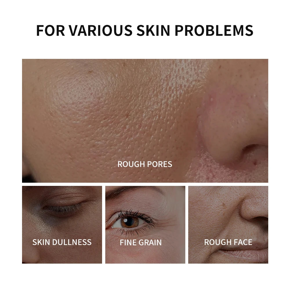 Face Tension Cream for Flawless Skin - 3