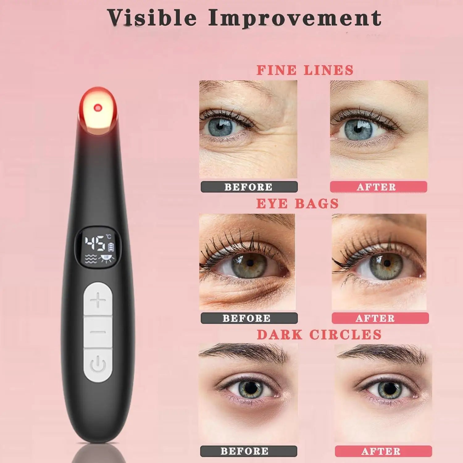 Eye Beauty Device with Heat and Vibration for Puffiness - 2