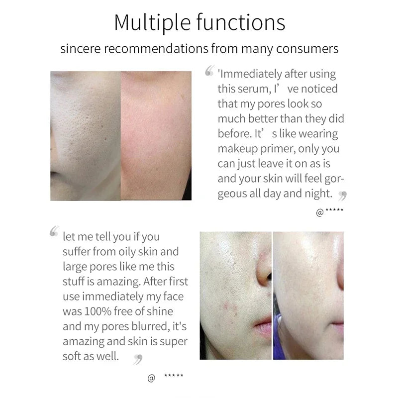 Pore Shrinking Serum for Smooth Skin - 14