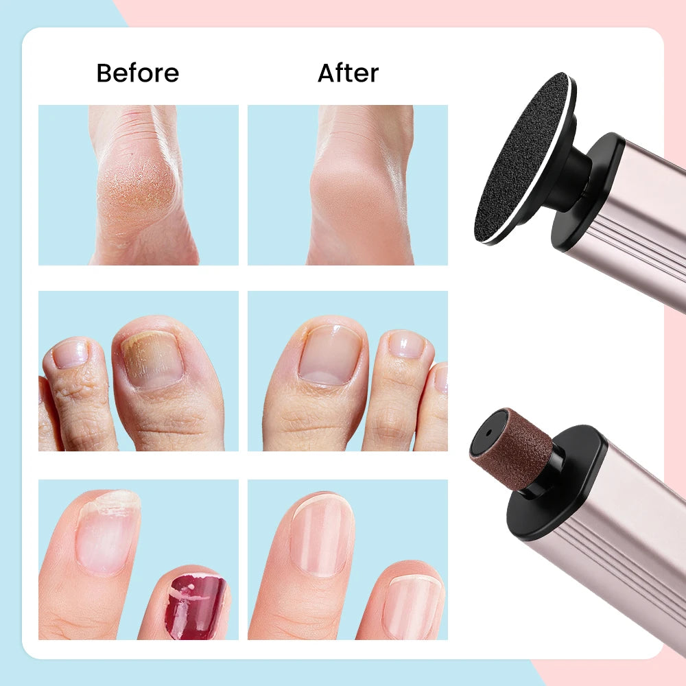 Electric Foot Callus Remover with Adjustable Speed Settings