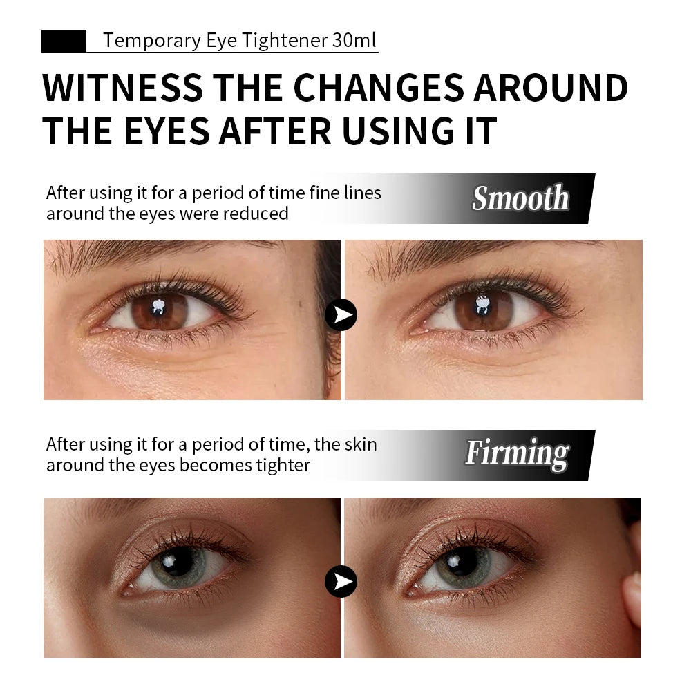 Temporary Eye Tightener Cream for Youthful Skin