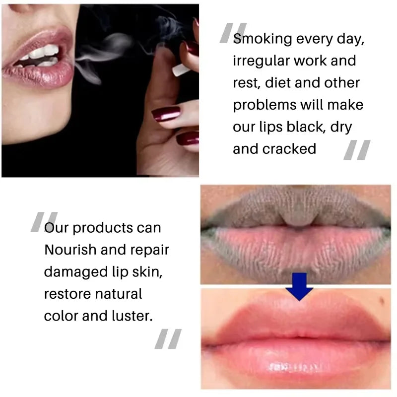 Lip Repair Mask to Fade Dark Spots and Moisturize