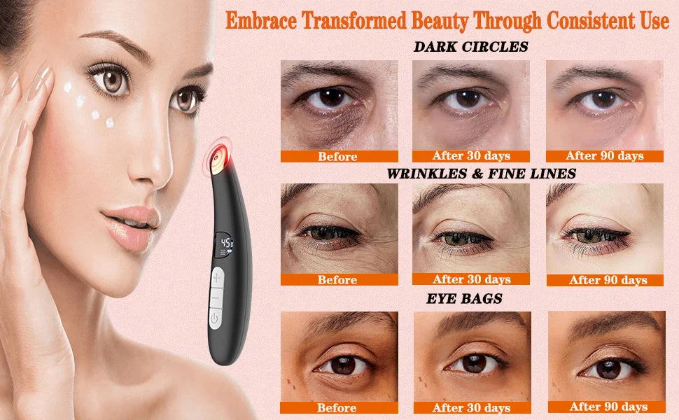 Eye Beauty Device with Heat and Vibration for Puffiness - 10