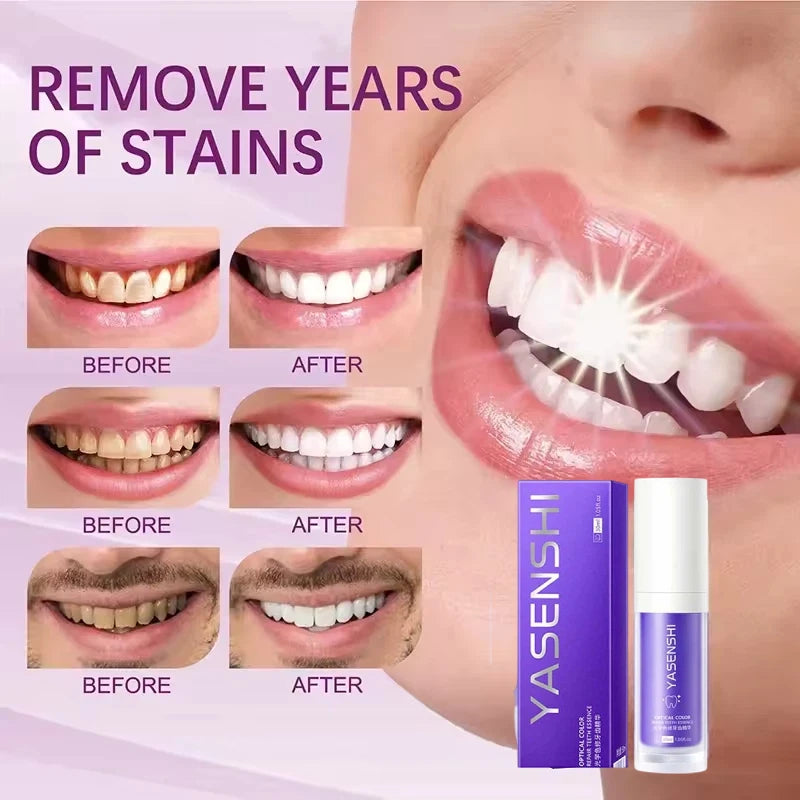 Whitening Toothpaste for Deep Cleaning and Fresh Breath