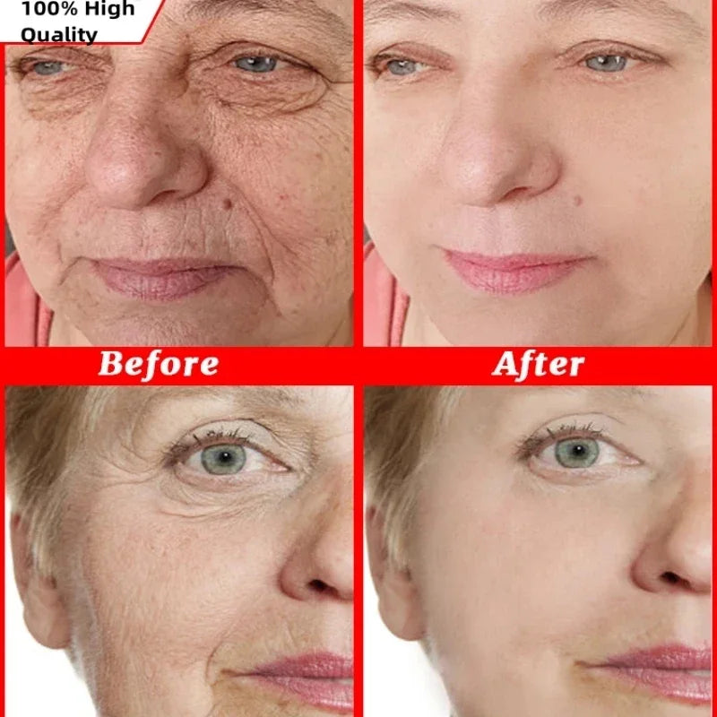 Anti Wrinkle Face Cream for Firming and Moisturizing