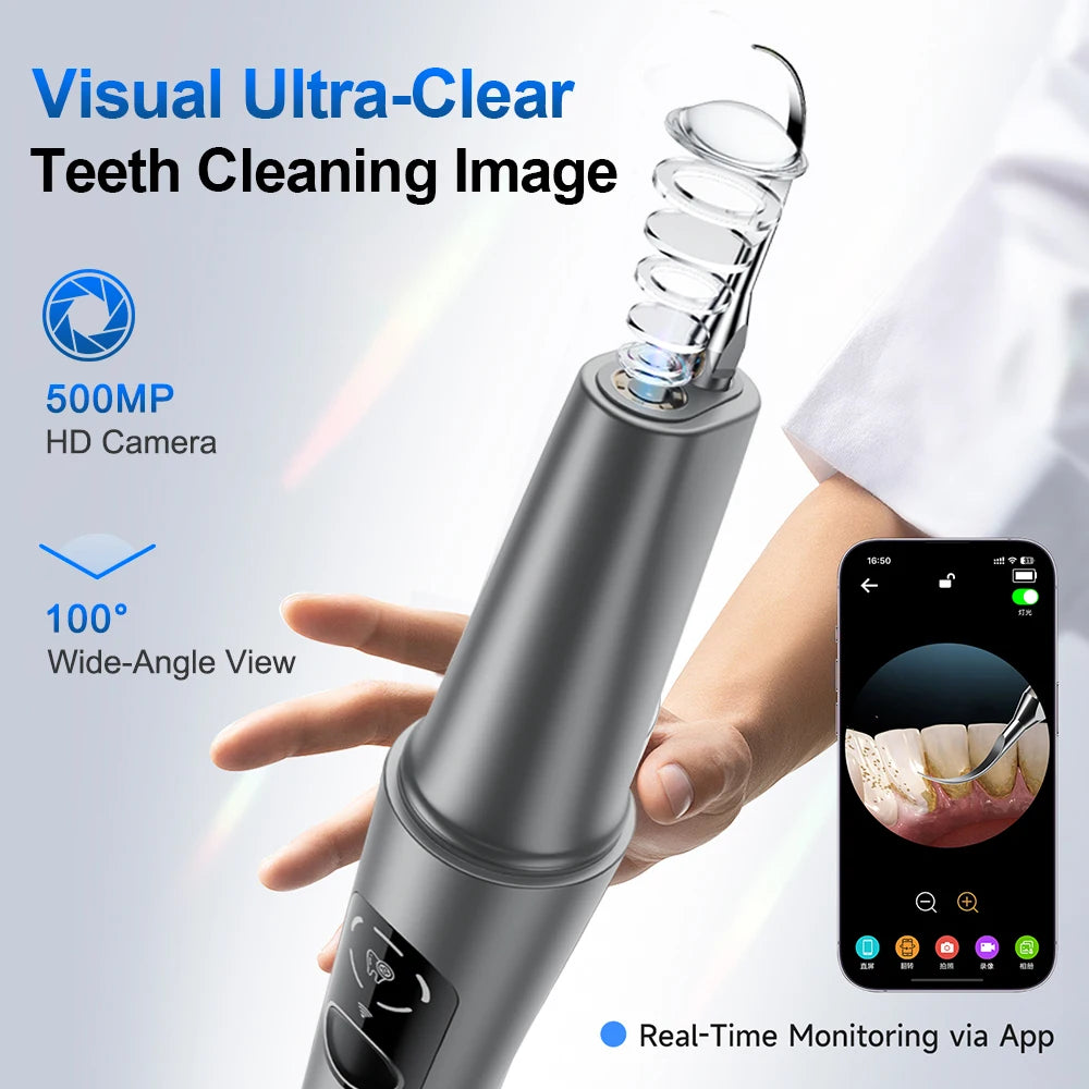 Visual Ultrasonic Dental Scaler with HD Camera for Plaque Removal