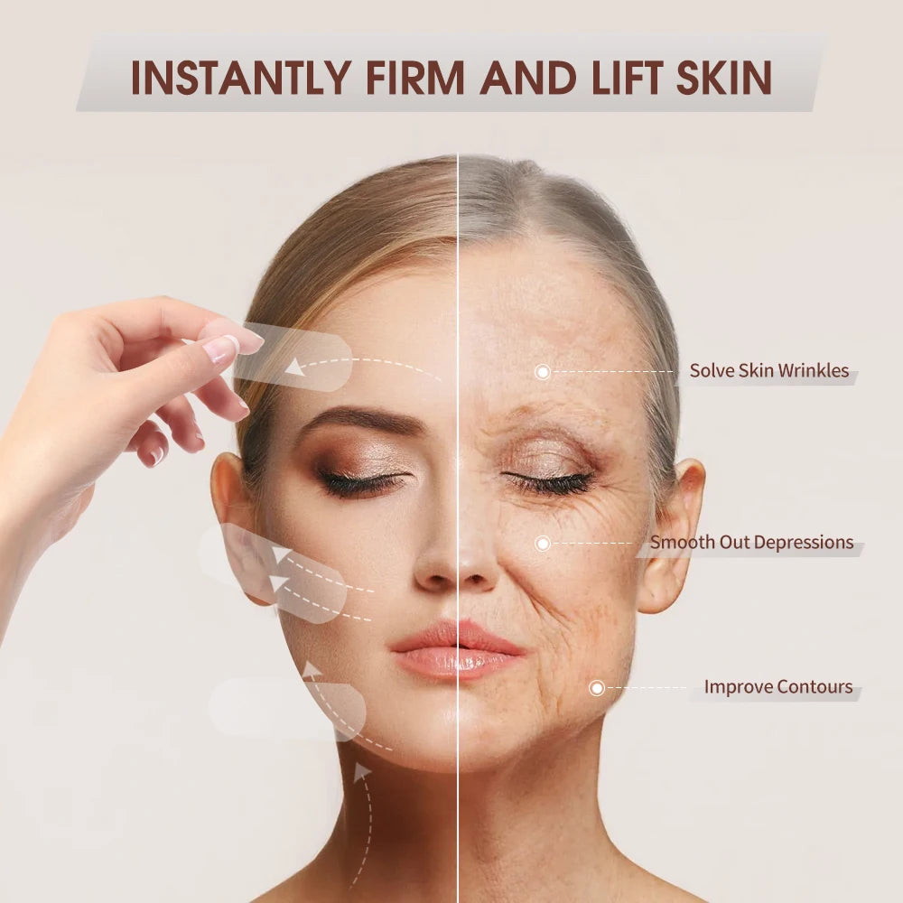 Invisible Face Lifting Patch for Instant V-Shape Contouring