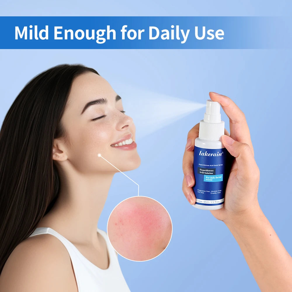 Hypochlorous Acid Facial Spray for Skin Recovery